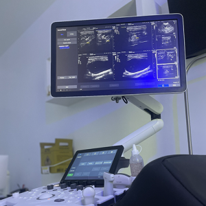 ultrassom